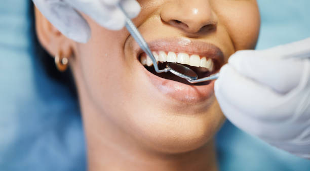 Best Emergency Dentist for Lost Fillings or Crowns in Bernice, LA