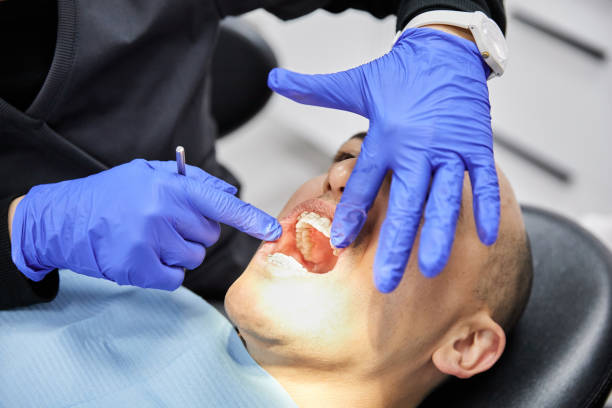 Best Emergency Dental Care for Abscessed Tooth in Bernice, LA